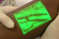 The device shows veins on the surface of the skin