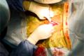 Small heart pacemakers and wireless charging