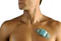 Detection of arrhythmias by tiny devices