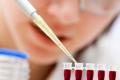 Molecular detection helps extract stem cells for blood cancer treatment