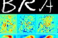 The machine 'penetrates' the human brain