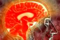 The device read the brain waves accurately, safely