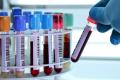 Instructions on how to read blood test results