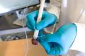 The pen detects cancer for 10 seconds