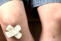Medical bandages have the ability to heal wounds by ... sucking bacteria