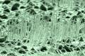 Fabrication of biological sensors from UNCD nanowires