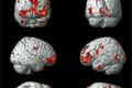 The brain activity corresponds to every human emotion
