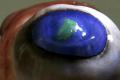 Super thin film can help the laser eye