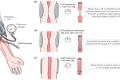 Warning about the type of application for fingerprint blood pressure measurement is very dangerous