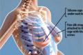 Breast lifting gown under the skin