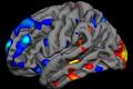 The brain scanner finds autism for 15 minutes
