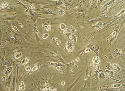 Picture 1 of 10 breakthroughs of world medicine 2008