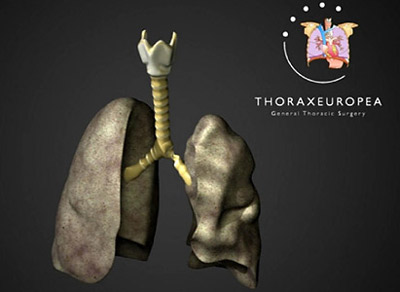 Picture 10 of 10 breakthroughs of world medicine 2008