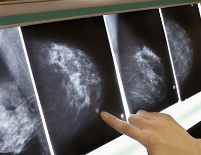 Picture 7 of 10 breakthroughs of world medicine 2008
