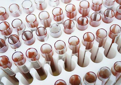 Picture 8 of 10 breakthroughs of world medicine 2008