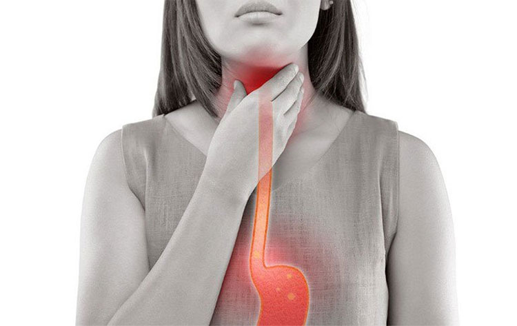 Picture 2 of 10 causes the throat to feel entangled