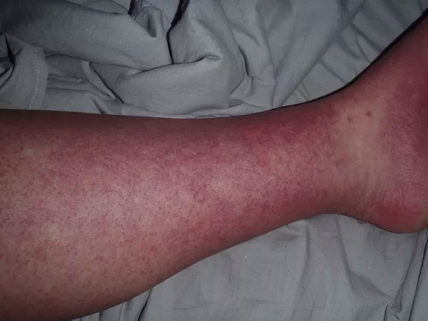 Picture 1 of 10 diseases will kill you in just 24 hours