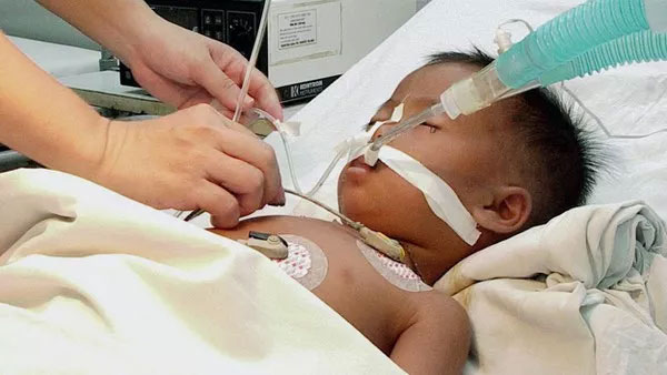 Picture 4 of 10 diseases will kill you in just 24 hours