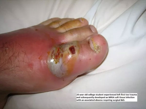 Picture 6 of 10 diseases will kill you in just 24 hours
