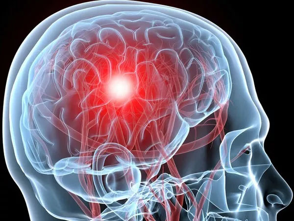 Picture 7 of 10 diseases will kill you in just 24 hours