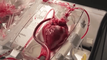 Picture 8 of 10 facts that make you fall back on your body