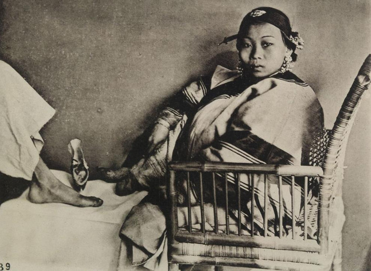 Picture 8 of 10 horror beauty trends that made women in ancient times crazy