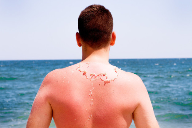 Picture 2 of 10 interesting things about human skin