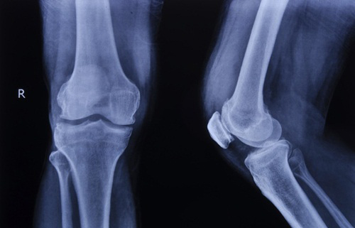 Picture 4 of 10 interesting things about the human skeleton