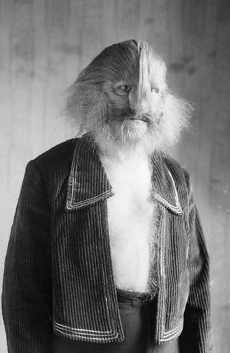 Picture 4 of 10 most hairy mutant on the planet