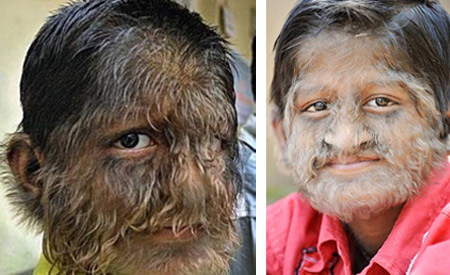 Picture 5 of 10 most hairy mutant on the planet