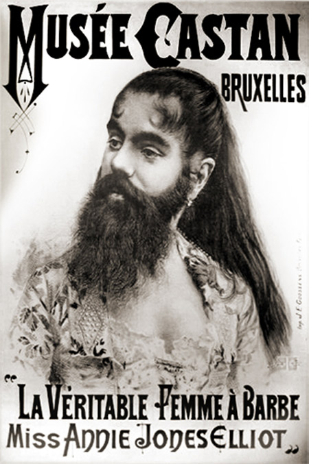 Picture 6 of 10 most hairy mutant on the planet