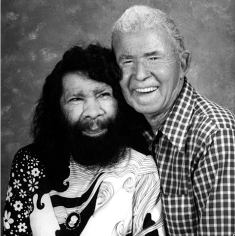 Picture 9 of 10 most hairy mutant on the planet