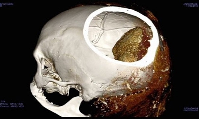Picture 8 of 10 mummies contain many mysteries