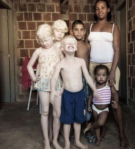 Picture 10 of 10 rare albino species