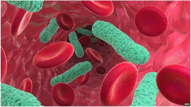 Picture 8 of 10 reasons why antibiotic resistance is scary right now