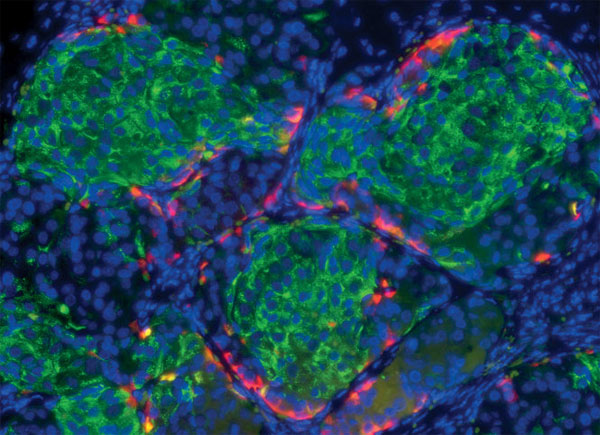 Picture 7 of 10 scientific breakthroughs in 2014