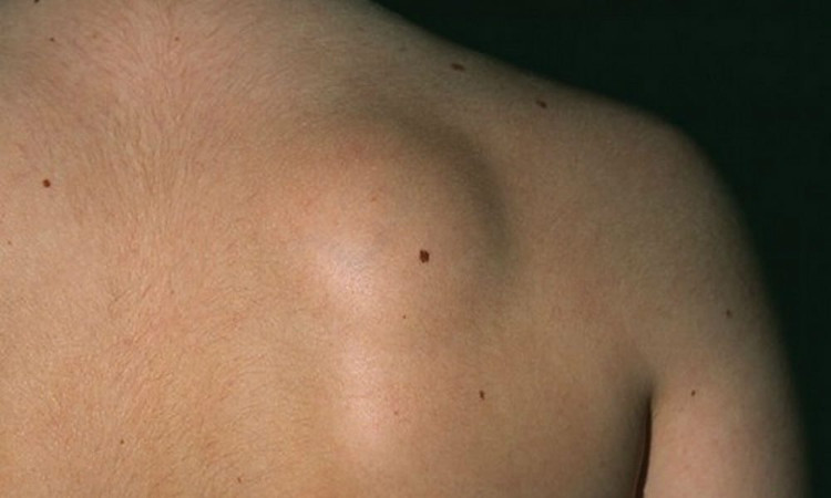 Picture 3 of 10 signs of cancer are growing in the body, everyone must be satisfied