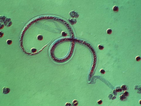 Picture 7 of 10 small enemies eat on human bodies