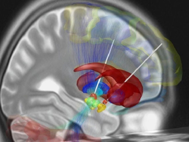 Picture 9 of 10 world medicine breakthroughs in 2018