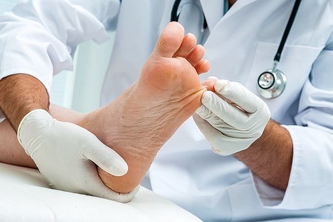 Picture 9 of 11 tips to remove foot odor effectively