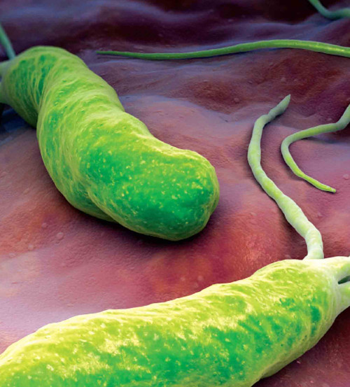 Picture 4 of 116 culprits cause cancer
