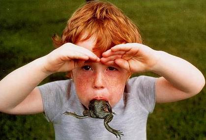Picture 3 of 14 most bizarre diseases in the world