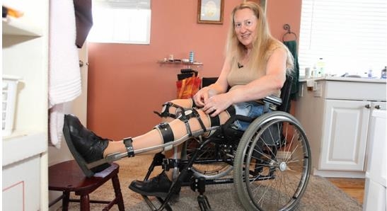 Picture 8 of 14 most bizarre diseases in the world