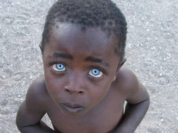 Picture 9 of 19 most obsessive eyes in the history of world photography