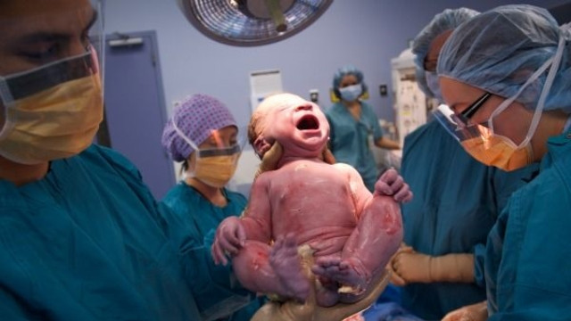 Picture 4 of 2 benefits and harms of caesarean section compared to normal delivery