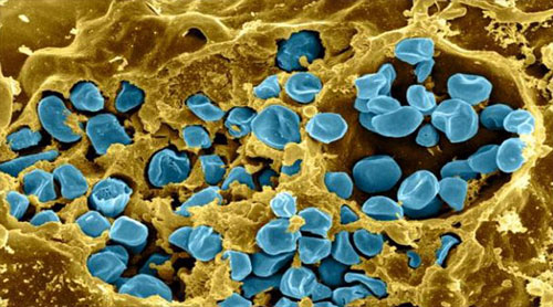 Picture 3 of 2 breakthrough inventions affect the future of humanity