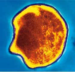 Picture 6 of 2005 Biomedical Nobel Prize - A realm goes back to bacteria