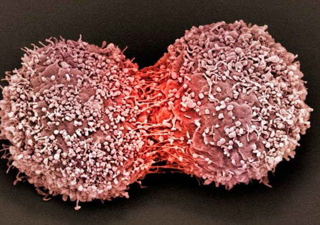 Picture 2 of 3 golden rules stop tumor formation in the body