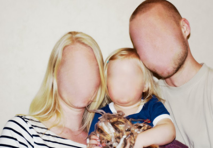 Picture 1 of 3% of the population is suffering from a syndrome that we all never knew