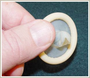 Picture 3 of 3,000 years of ups and downs of condoms
